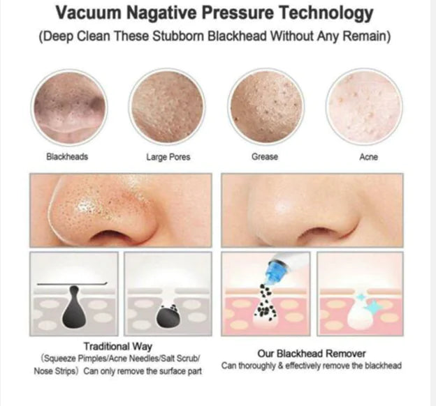 Electric blackhead suction tool for pore cleaning