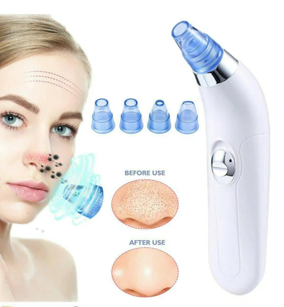 Electric blackhead suction tool for pore cleaning